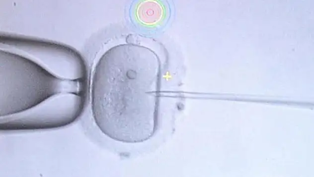 Üç ebeveynli bebek uygulaması İngiltere'de başlıyor