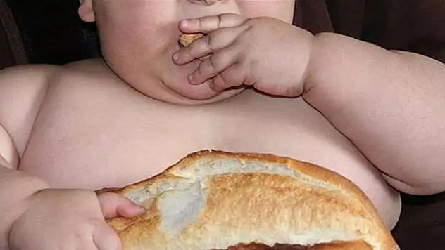 'Türkiye'de 3 milyon obez var'