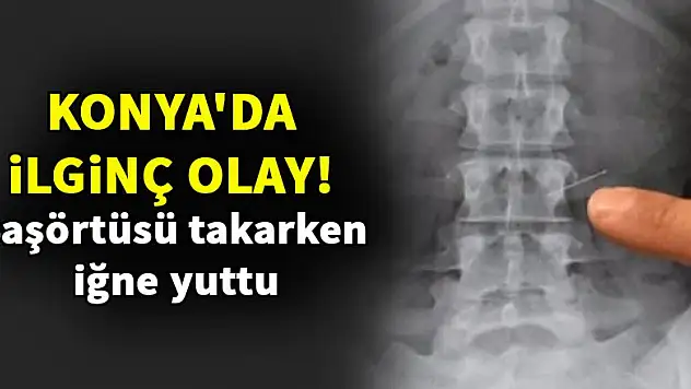 Konya'da ilginç olay! Başörtüsü takarken iğne yuttu