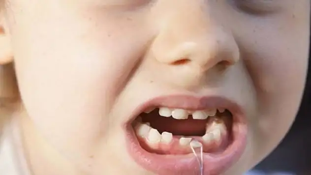 Süt dişlerini atmayın!