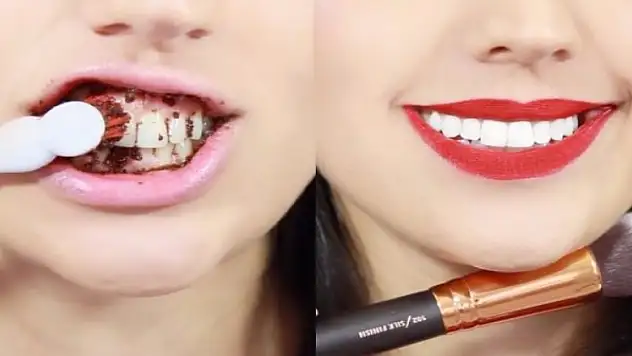 Evde diş beyazlatırken buna dikkat!