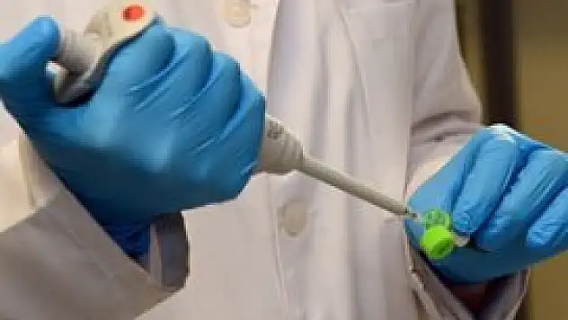 AIDS tedavisinde yeni umut