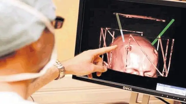 Müthiş haber! Bilim insanları beyin üretti