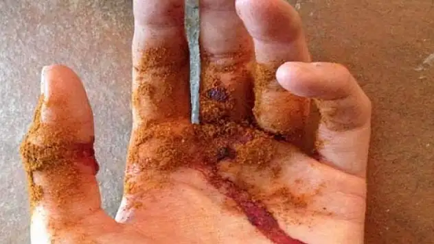 Yaranın üzerine dökünce kanı durduruyor