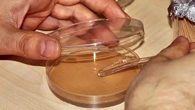 Antibiyotiğe dirençli mikroorganizmaların geçmişi sanılandan daha eski