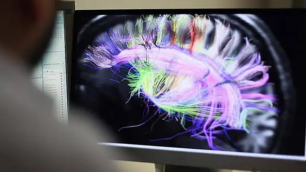 Deliryumun nedeni bulundu