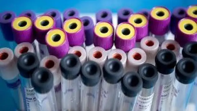 Hepatit B, C ve D virüsleri 'sinsi' gelişiyor