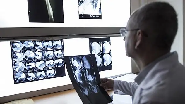 Radyasyon çocuklarda kanser riskini 5 kat artırabiliyor