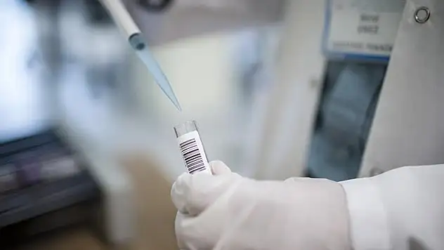 Kan tahlili ve ilaç kullanımında cinsiyete dikkat