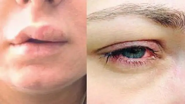 İnternette kapış kapış gidiyor! Büyük tehlike...