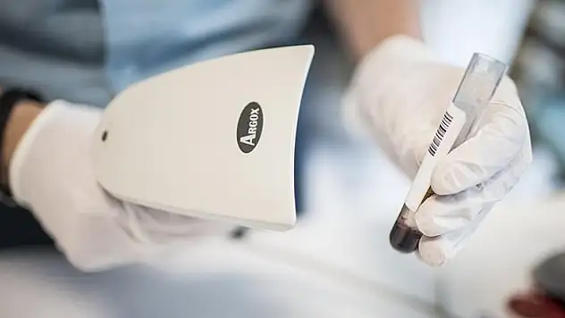 Prof. Dr. Aygen: Hepatit C, 15-20 yıl içinde yok edilebilecek