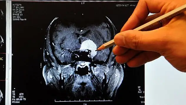 Kadınların beyinleri erkeklerinkinden daha aktif