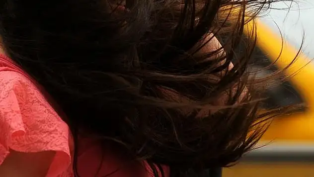 'Kadınlarda saç dökülmesi önlem alındığında durdurulabilir'