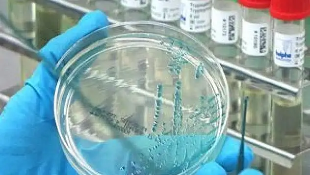 H10N8 kuş gribi virüsü insana bulaştı