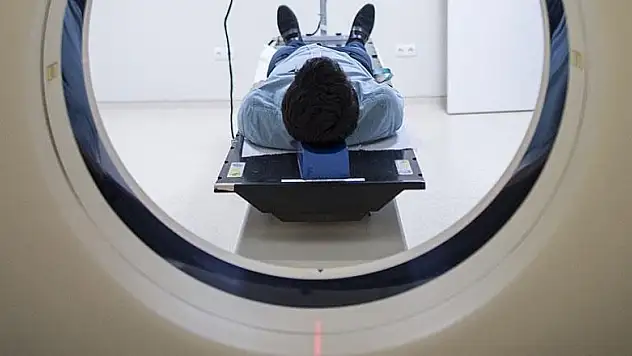 Alzaymırı erken teşhis yöntemi geliştirildi