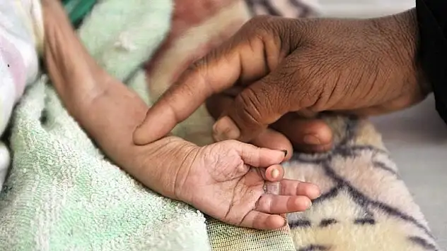 'Açlığı silah olarak kullanmak savaş suçudur'