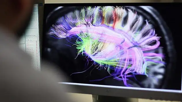 Beynin elektrik bağlantılarının haritası çıkarıldı