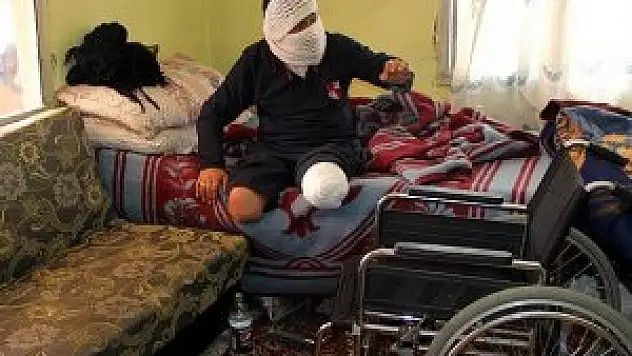 Savaşın yarım bıraktığı bedenler