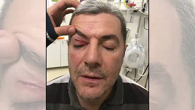 Konyasporlu yöneticinin gözü patladı! Trabzonspor maçında şok olay...