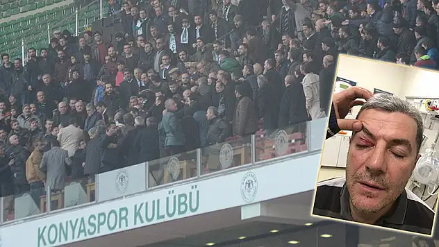 Trabzon maçında kaşı açılan yönetici konuştu