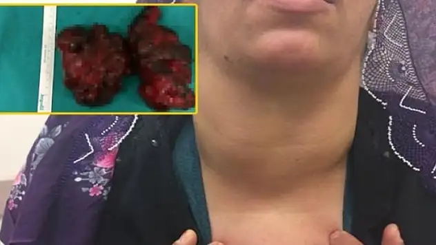 Boynundan çıkarılan şeye doktorlar bile inanamadı