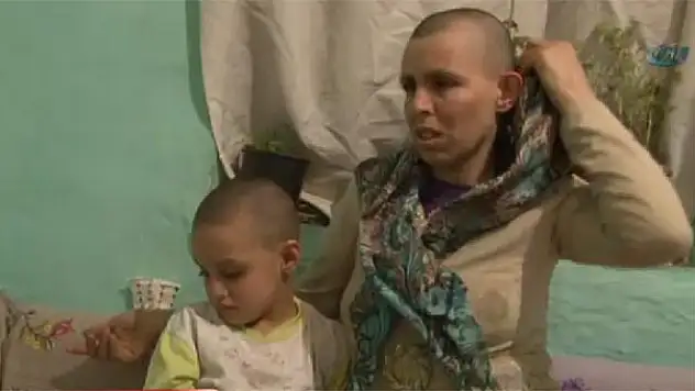 Skandal - Meram Tıp'dan saçlarını kaztılar, bitlisin deyip taburcu ettiler