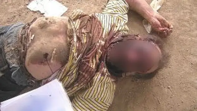 Suriye'de işkence fotoğraflarda görünenden daha fazla