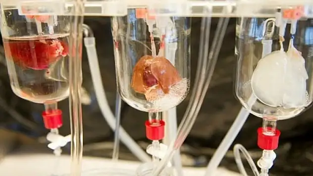 Roket teknolojisiyle yapay kalp geliştirildi