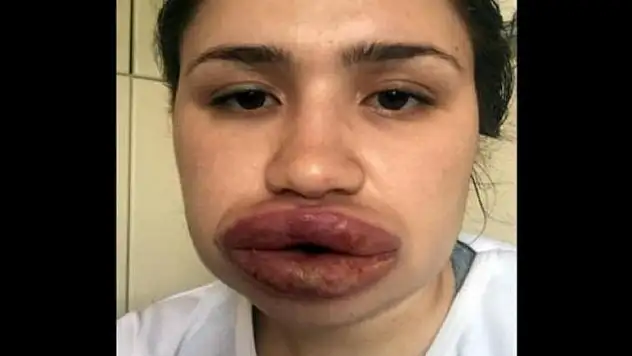 Türkiye onu böyle tanımıştı! İşte son hali