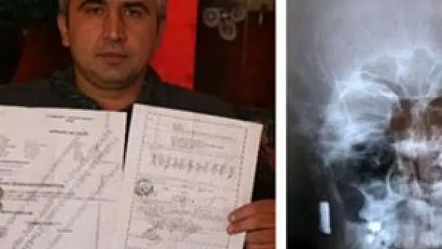 Kafasındaki kurşun 20 yıl sonra tespit edildi