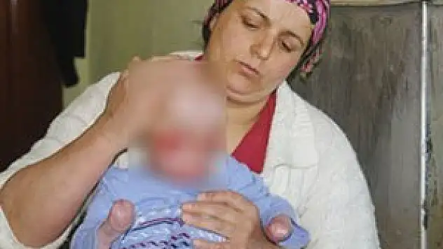 Eğer yüz nakli olursa dünya onu konuşacak