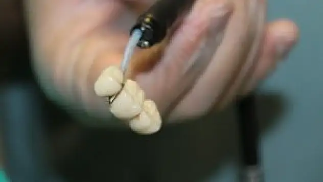 Kahvaltı yaparken dişini yuttu