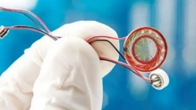 14 polise böcek sorgusu