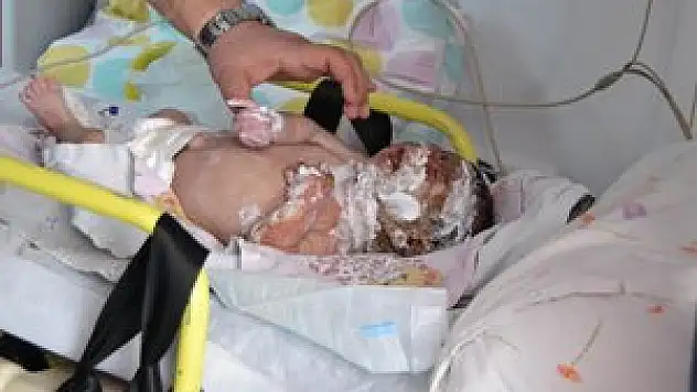 Çadırda yangın çıktı 45 günlük bebek ağır yaralandı