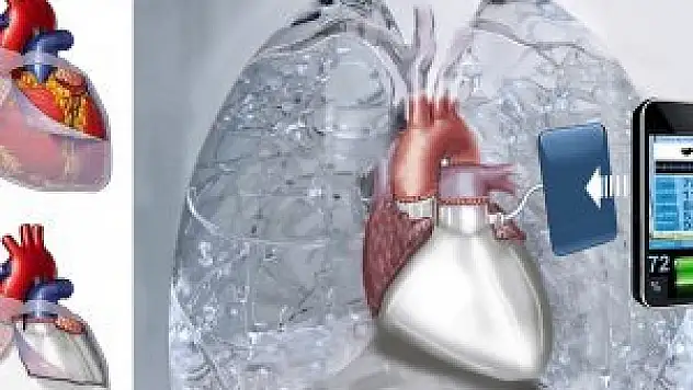 SÜ, yapay kalbiyle Türkiye'yi Cenevre'de temsil edecek