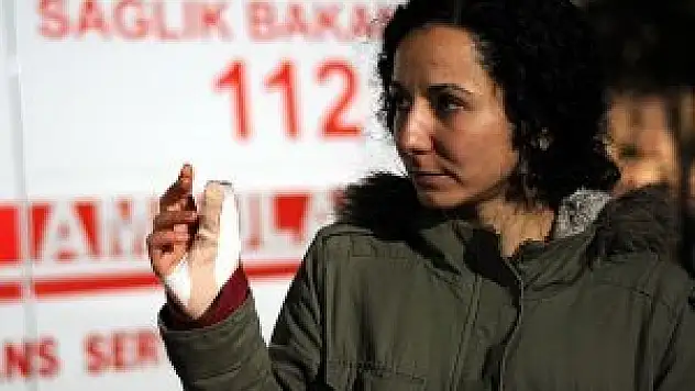 Başkentteki protestoda AA fotomuhabiri yaralandı