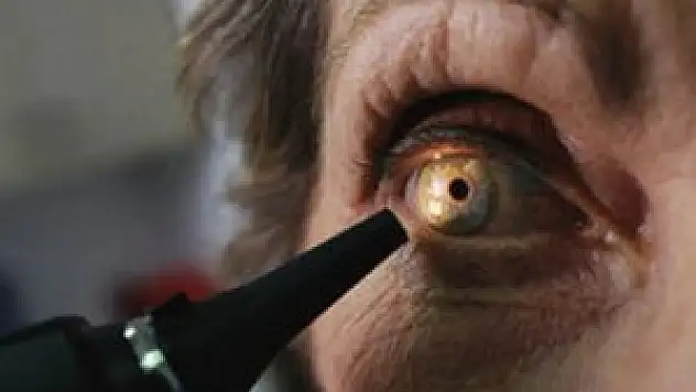 Kirpikler için kullanılan bu ürünlere dikkat!