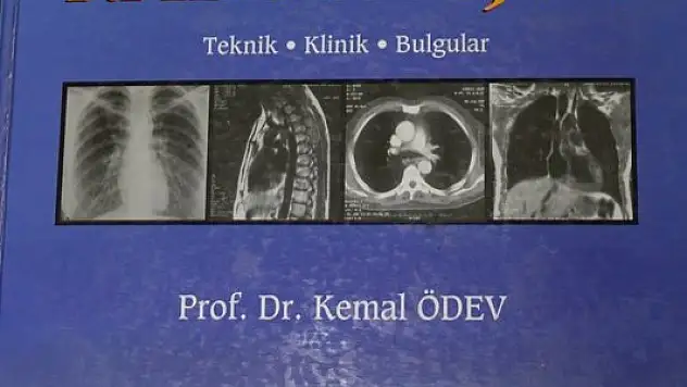 Çektiği röntgen filmleriyle kitap yazdı