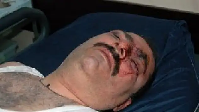 Mansur Yavaş'a 'davanı sattın' dedi, komalık oldu