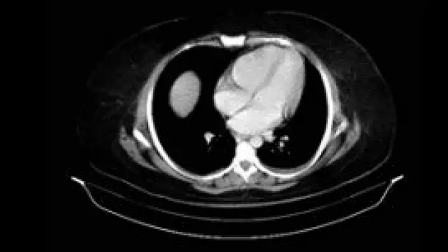 Hastaneye gidince öğrendi!