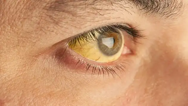 Tırnak makası ve tıraş bıçağınızı kimseyle paylaşmayın!