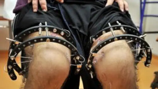 Kemik tedavisinde yeni buluş