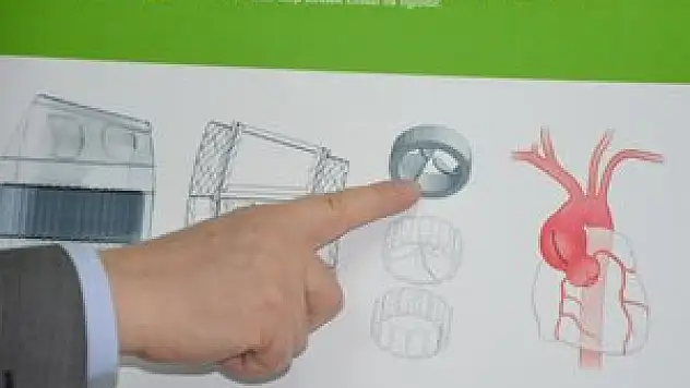 Aile buluşu ile kalp hastalarına çare olacak