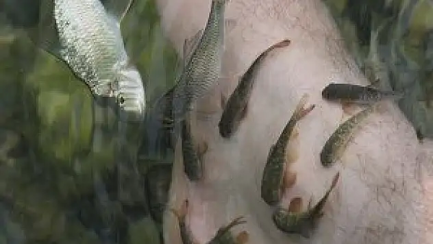 'Doktor balıklar'a Rus ilgisi