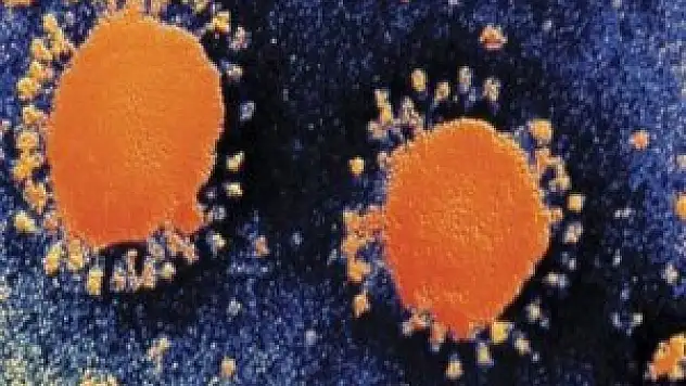 Doğu'da SARS, Batı'da MERS!