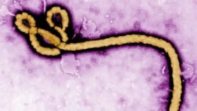 Afrika'ya gideceklere 'Ebola' uyarısı