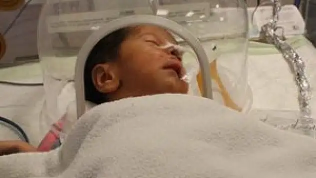 3 günlük bebeğe yemek borusu ameliyatı