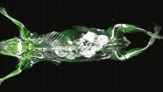 Tıpta devrim! Türk bilim insanı görüntüledi