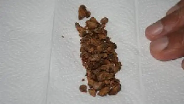 Mesanesinden 74 taş çıktı