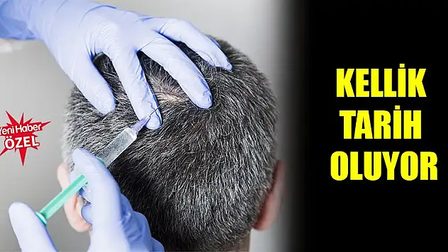 Kellik tarih oluyor
